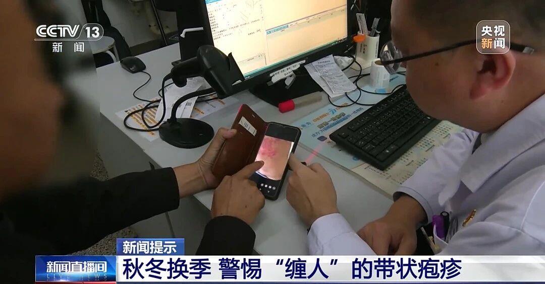 “最疼皮膚病”進入高發期 出現這些疼痛信號別大意